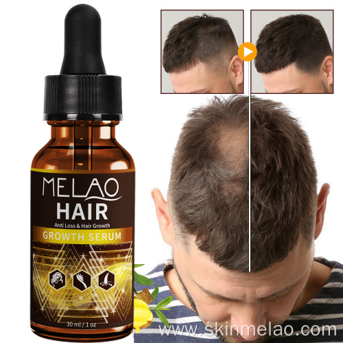 Anti Hair Loss Boosting Hair Growth Serum